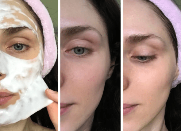 Альгинатная маска до и после фото